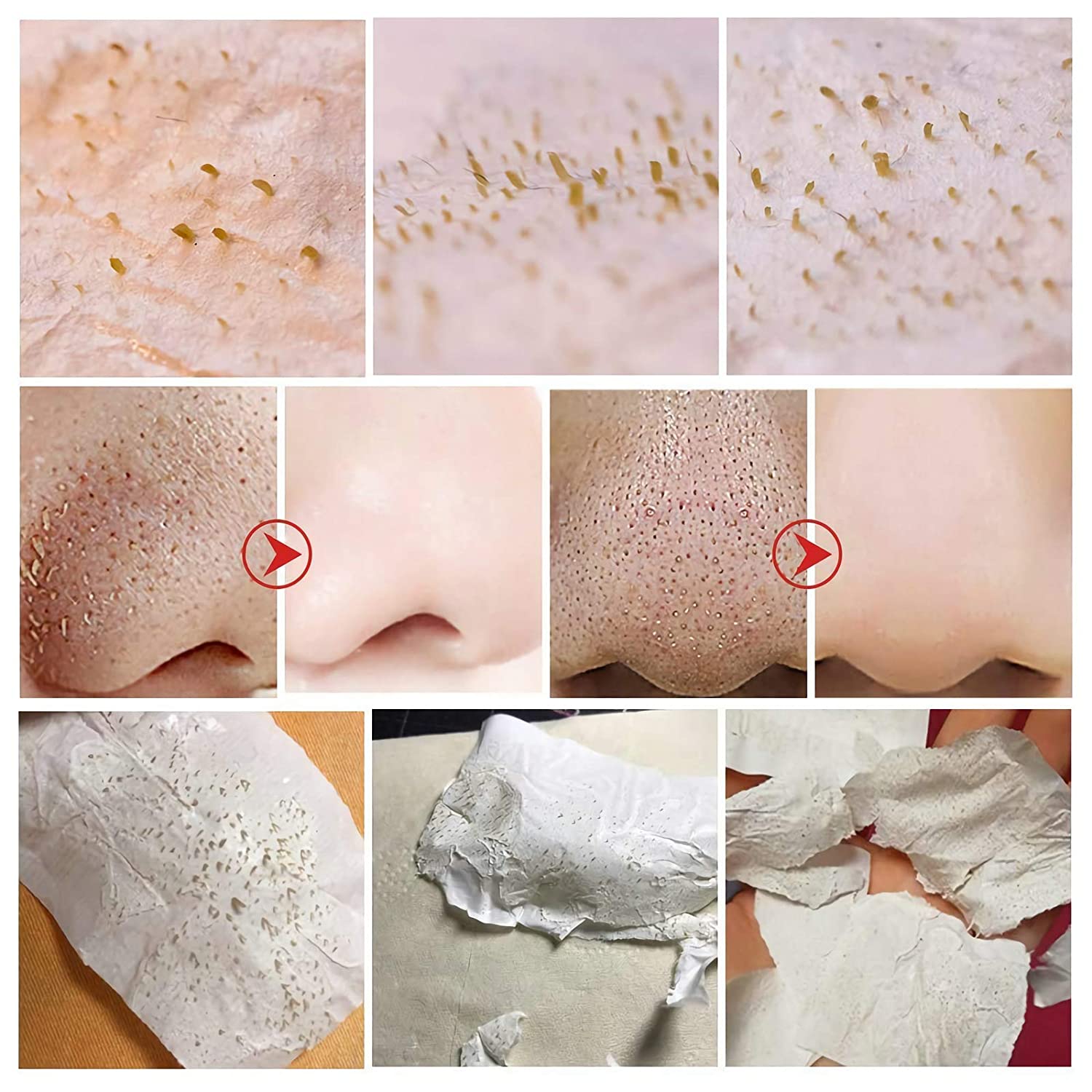 چسب بینی لانبنا lanbena | ضد جوش سر سیاه