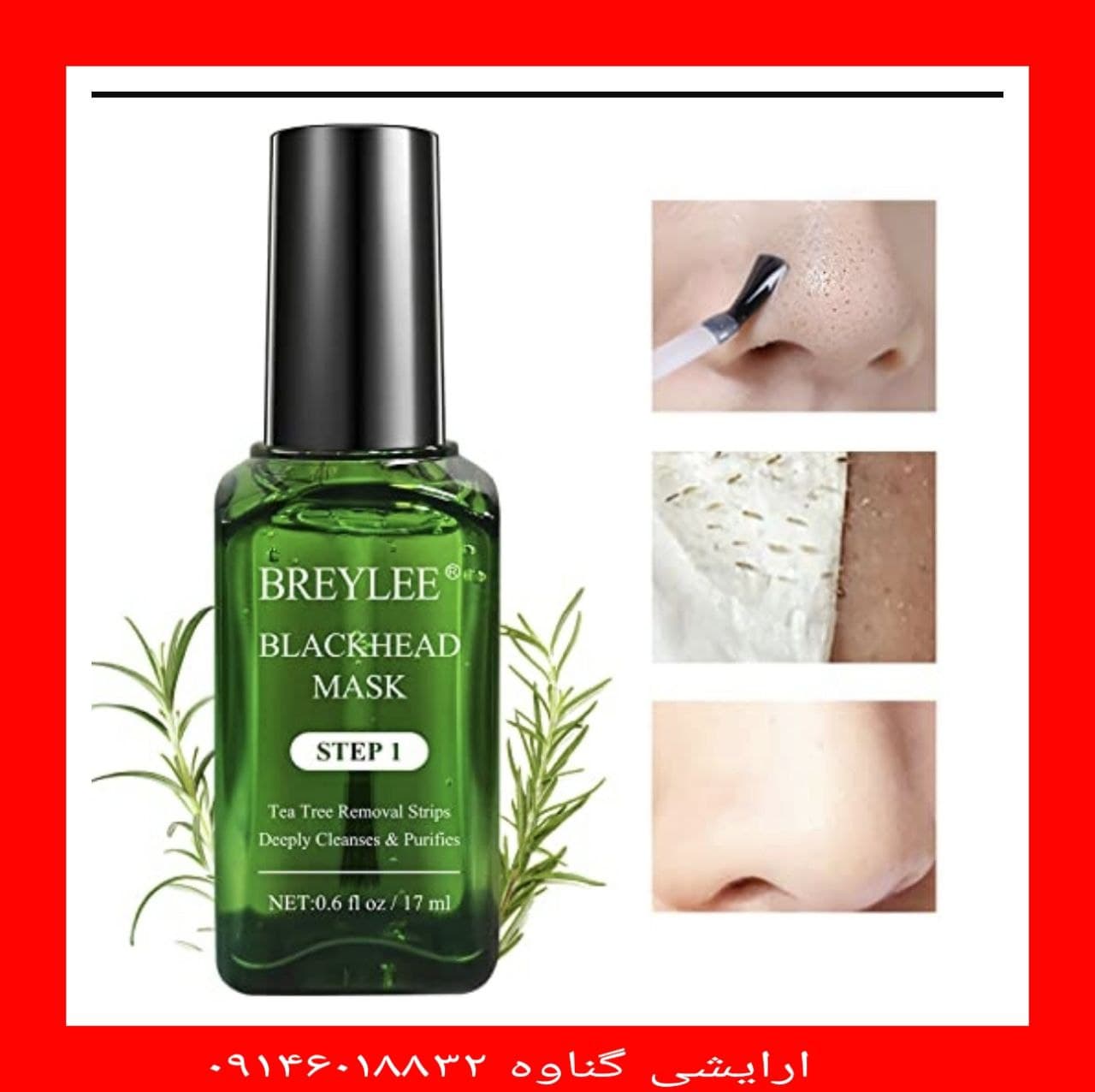 سرم چسب جوش های سر سیاه بریلی BREYLEE سرم چسب جوش های سر سیاه بریلی BREYLEE
