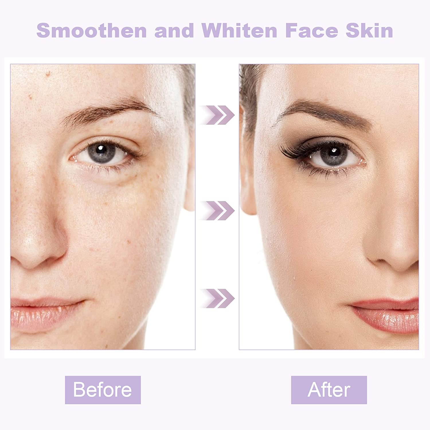 استیک ماسک جادویی بادمجان مدیان از بین برنده جوش های سر سیاه