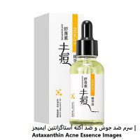 سرم ضد جوش و ضد آکنه آستاگزانتین ایمیجز